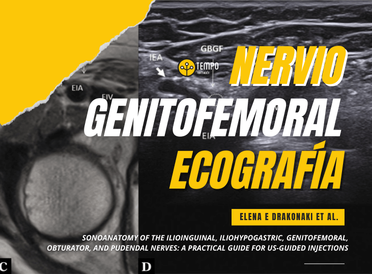 nervio-genitofemoral-y-ecografia